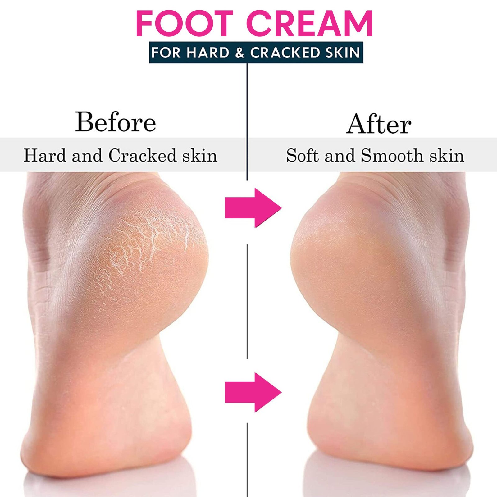 Kayamaya Crack Feet Cream for Cracked Heels – Deep Moisturizing Foot Cream for Dry, Rough, Hard & Callused Skin | Soft & Smooth Feet Care, 50g - Image 3