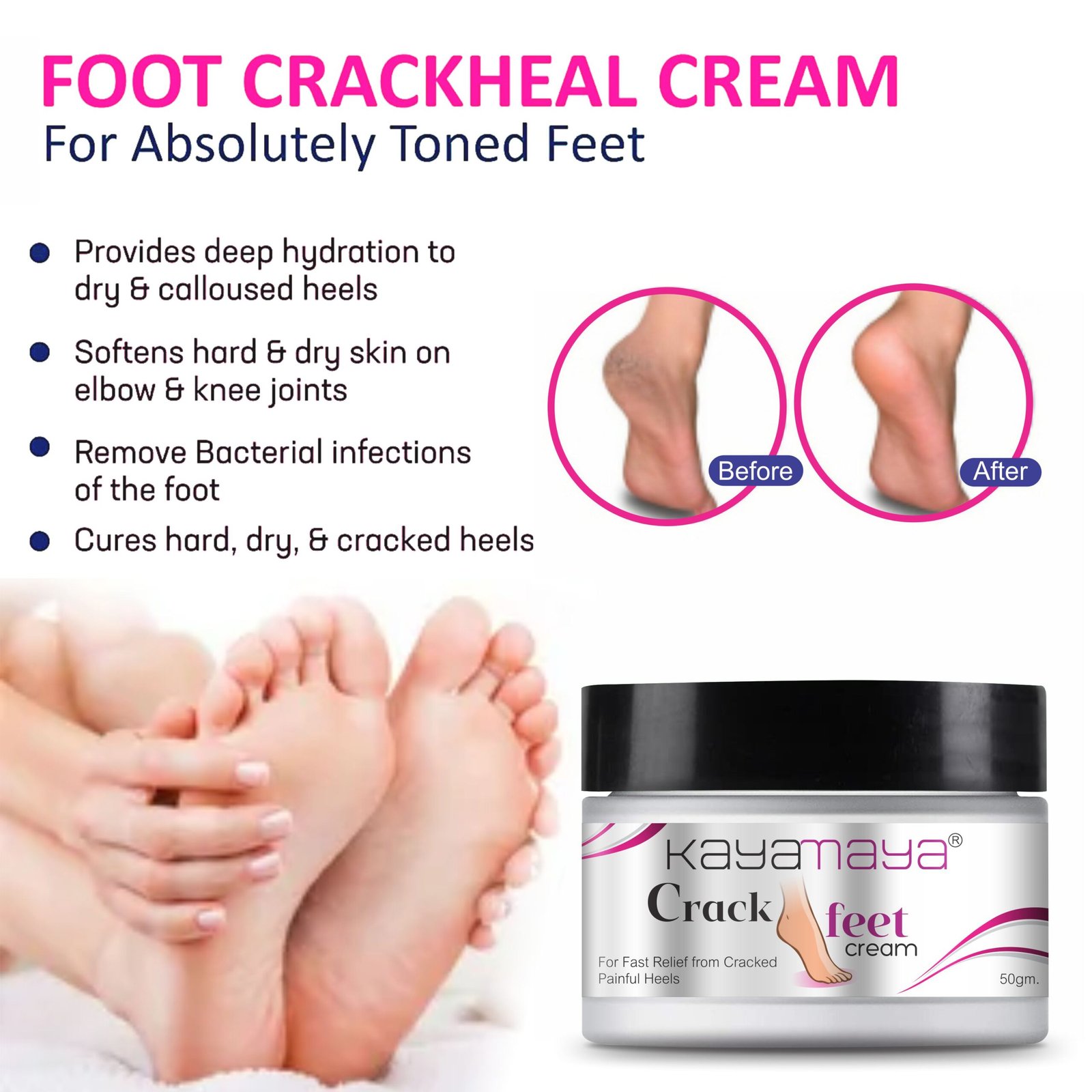 Kayamaya Crack Feet Cream for Cracked Heels – Deep Moisturizing Foot Cream for Dry, Rough, Hard & Callused Skin | Soft & Smooth Feet Care, 50g - Image 4